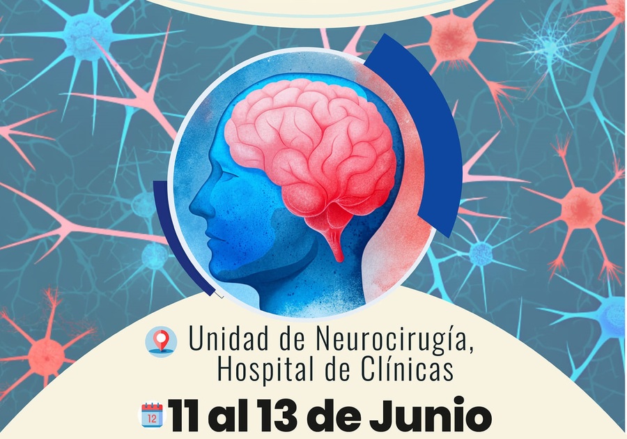 Ponen en marcha campaña de cirugías de tumores cerebrales que beneficiará a pacientes mediante el SUS
