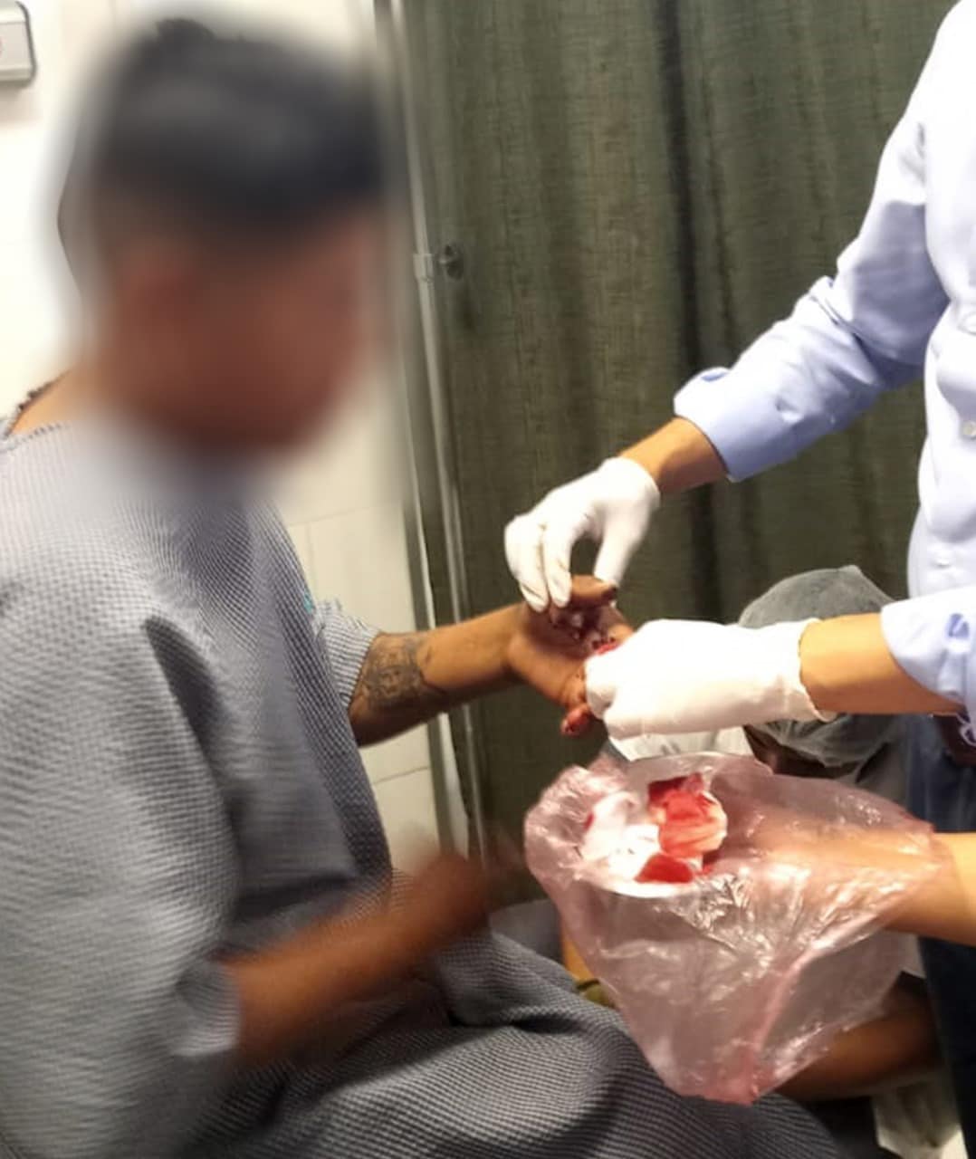 Artefacto explota y deja soldado herido en Parotani, Gobierno ve probable hayan dejado el lugar minado