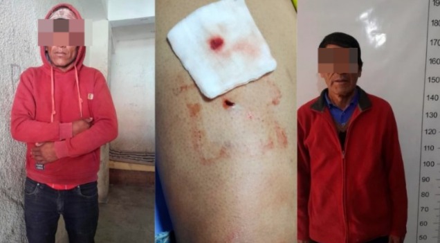 Aprehenden a hombres que apuñalaron a un motociclista en bloqueos de Oruro 