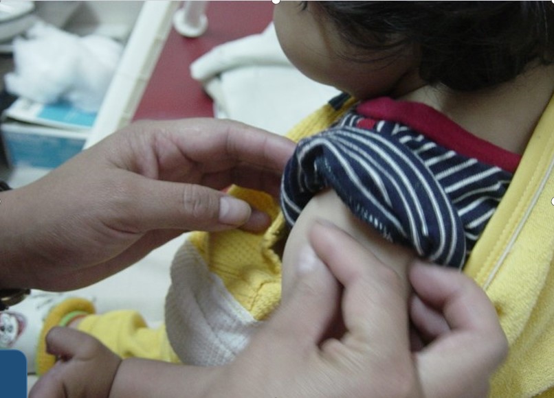 Número de casos de sarampión en Bolivia sube a 86