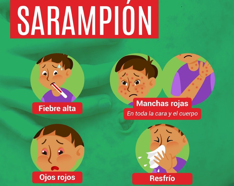 En Santa Cruz piden a los padres llevar a sus niños a vacunar para contener el brote de sarampión
