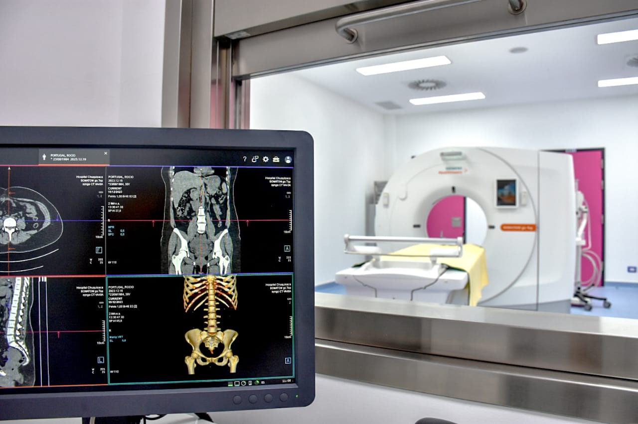 Cáncer: El SUS convirtió los tratamientos de quimioterapia y radioterapia de Bs 50.000 a gratuitos