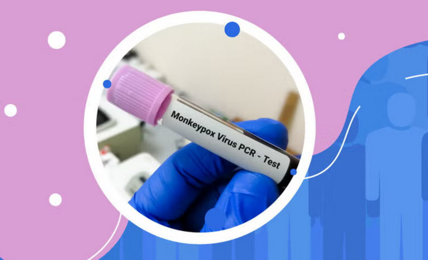 En Santa Cruz reportan 8 contagios de viruela del mono, 2 están internados por complicaciones