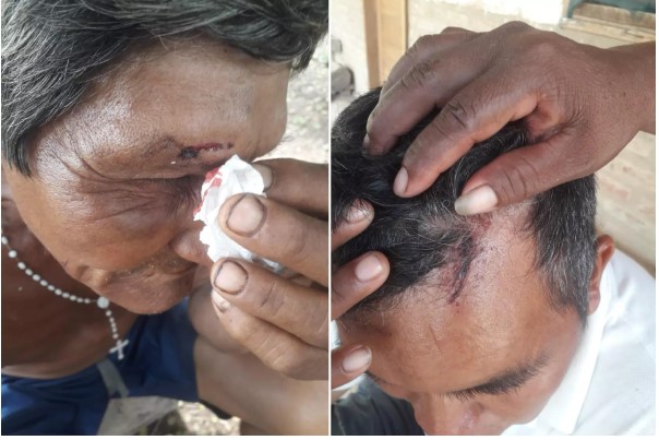 Organización denuncia “masiva violación de derechos humanos” por el paro en Santa Cruz