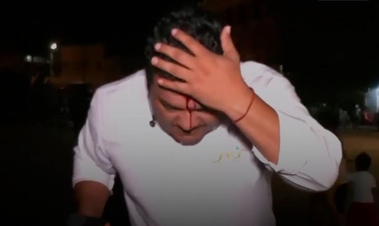 Violencia y agresiones contra periodistas recrudecen en los bloqueos en Santa Cruz