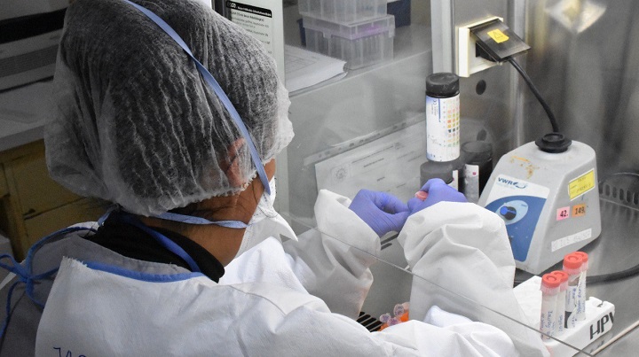 Salud reporta 75 casos activos de viruela símica