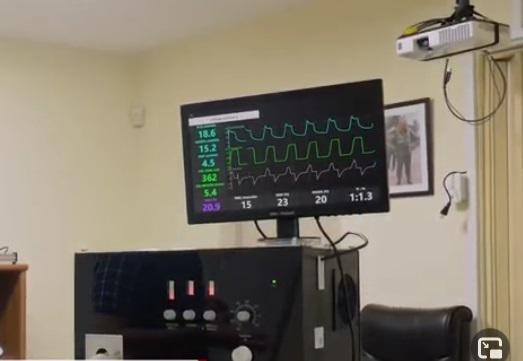 Cuba desarrolla cinco modelos de ventiladores pulmonares